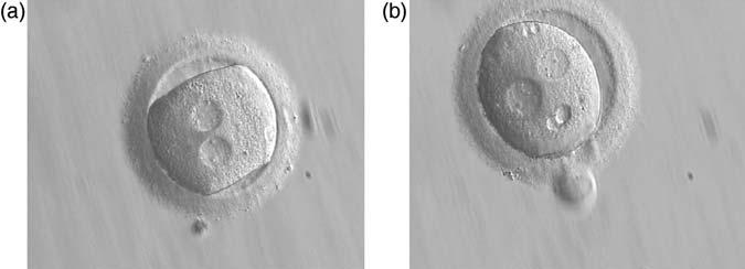 i34 Papale et al. Figure 136 A zygote with an irregular shape, generated by ICSI and observed 18 h (a) and 20 h (b) post-icsi (400 magnification).