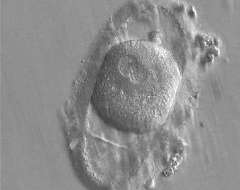 Figure 143 A deformed zygote at 16 h post-ivf displaying two PNs located peripherally in the cytoplasm (6 7 o clock) that are parallel to