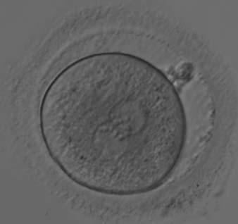 The zygote i37 Figure 152 A zygote observed 18 h post-icsi with equal numbers of NPBs aligned at the PN junction (200 magnification). It shows a large PVS and an irregular ZP.