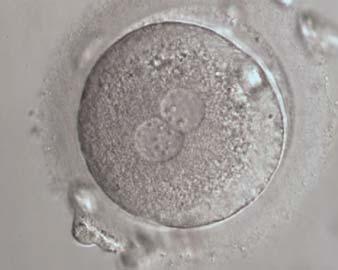 NPBs are scattered in both PNs (400 magnification). It was transferred but the outcome is unknown. Figure 158 A zygote generated by IVF at 16.40 h postinsemination (400 magnification).