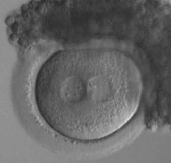 The zygote i39 Figure 162 A zygote observed 16 h post-icsi with small-sized NPBs scattered with respect to the PN junction in both PNs (400 magnification). It has a very thin ZP.