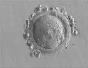 Figure 167 A zygote generated by IVF observed 17 h postinsemination (400 magnification).