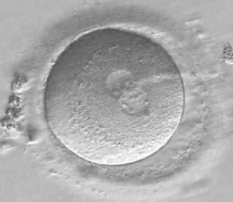 It was transferred but failed to implant. Figure 170 A zygote observed 16.