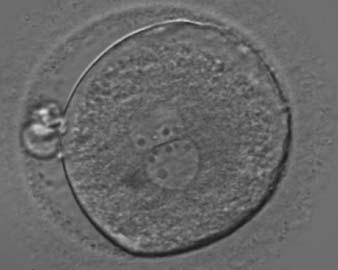 i42 Papale et al. nucleoli in determining embryo viability.