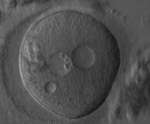 Figure 185 A zygote generated by ICSI showing two bull s eye PNs, each having a single large NPB (200 magnification).