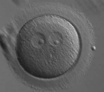 Figure 186 Oval-shaped zygote generated by ICSI, showing a single NPB in one of the two PNs ( bull s eye ) and small, scattered NPBs