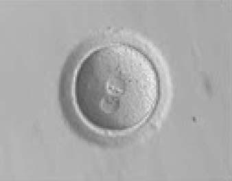 other (600 magnification). It was discarded. Figure 189 A zygote generated by ICSI with one bull s eye PN (400 magnification). The NPBs from each PN are aligned at the PN junction.