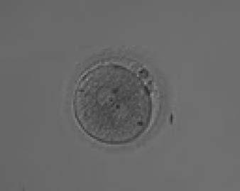 Figure 194 A zygote generated by ICSI showing normal cytoplasmic morphology except for a refractile body visible at the 3 o clock position in this view (400 magnification).