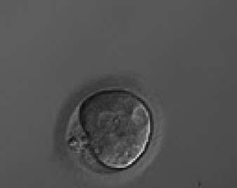 The zygote i47 Figure 203 A zygote generated by ICSI with an irregular oolemma and a large PVS with possibly highly fragmented polar bodies (150 magnification).