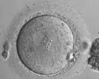 i24 Papale et al. Figure 87 A zygote at 18.5 h generated by standard insemination using frozen/thawed ejaculated sperm (400 magnification).