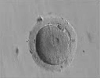 The zygote i25 resulting embryos has been reported to be significantly higher compared with embryos derived from 2PN oocytes (Yan et al., 2010).
