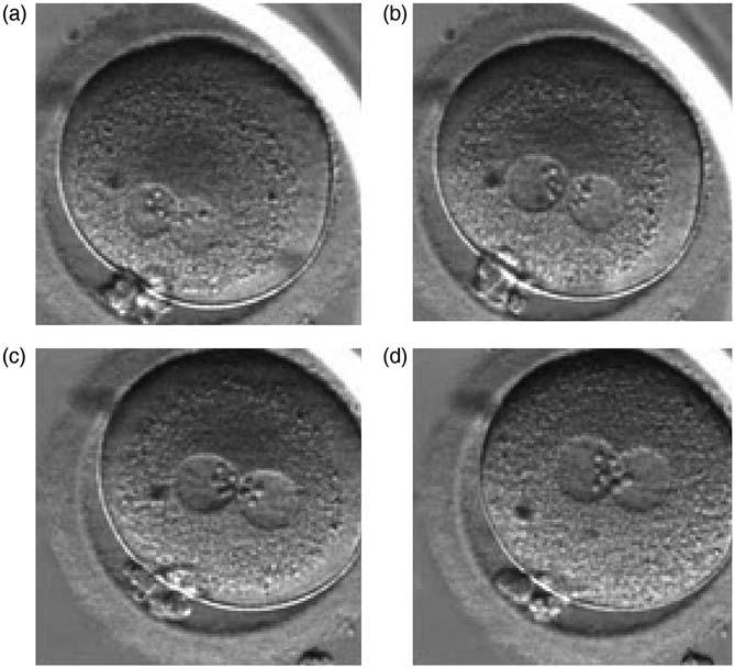 The zygote i27 Figure 101 A zygote with changes in PN pattern, particularly with respect to the position in the cytoplasm and the NPBs location over time at (a) 11.7, (b) 15.4, (c) 18.3 and (d) 28.