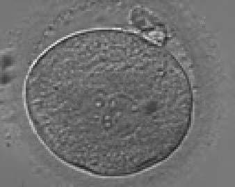 Figure 107 A zygote observed 18 h post-insemination displaying very unequal-sized PNs and inequality in