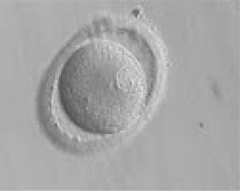 It was transferred on Day 3 (seven cells) along with two other embryos.