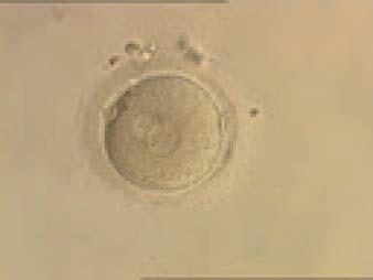 Figure 108 A zygote generated by ICSI with one large and one normal-sized PN (200 magnification).