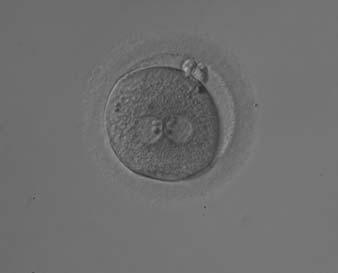 could result in altered development, i.e. fertilization failure and abnormal cleavage of the embryo (Gianaroli et al.