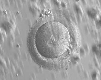 i30 Papale et al. Figure 115 A zygote with an equal number of large-sized NPBs aligned at the PN junction (400 magnification).