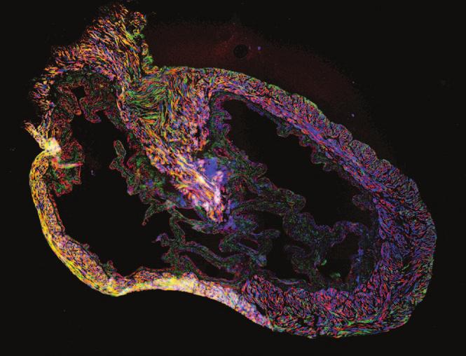 fluorescence mrking of norml bldder nd intestinl cells.