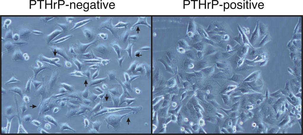 The Observation PTHrP negative H1944 cells are morphologically different than PTHrP positive