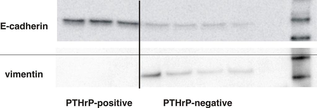 decreased in 3 PTHrP positive H1944