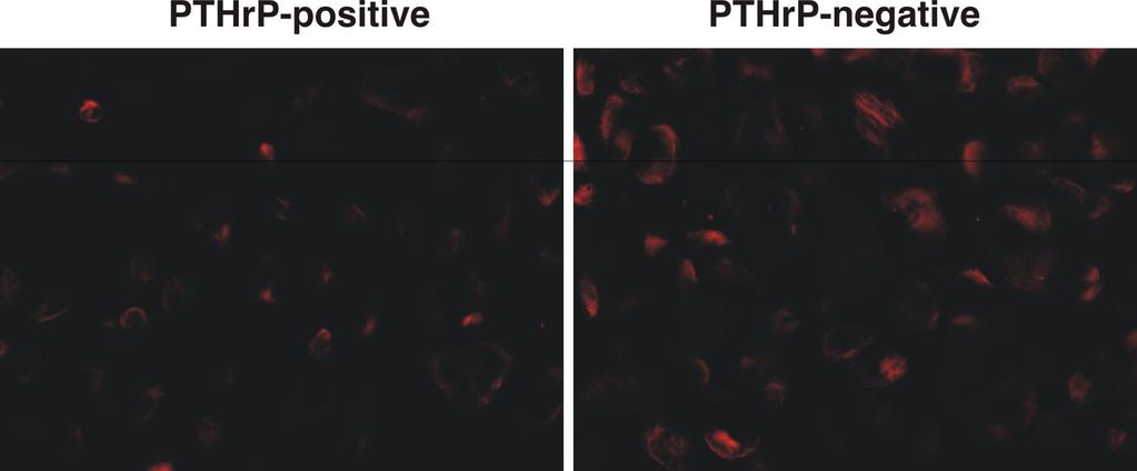 PTHrP decreases vimentin Vimentin immunofluorescence was