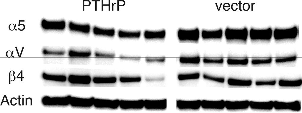 PTHrP affects integrin profile PTHrP positive H1944 cells expressed lower levels of a5