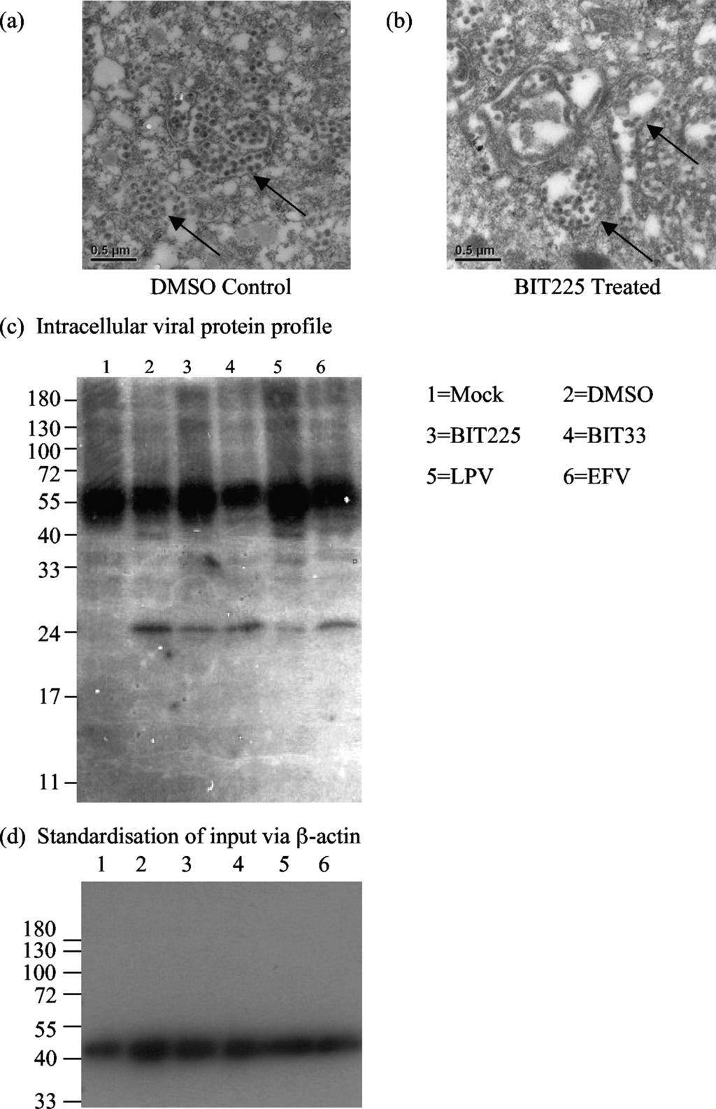 VOL. 54, 2010 BIT225, A NOVEL ANTI-HIV-1 COMPOUND TARGETING Vpu 843 FIG. 5. BIT225 results in defects in virion assembly.