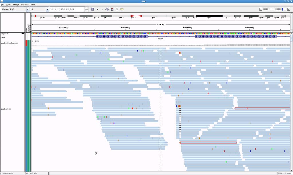 July 29, 2014 Micro-Assembly Approach to detect INDELs 38 Suspicious deletion