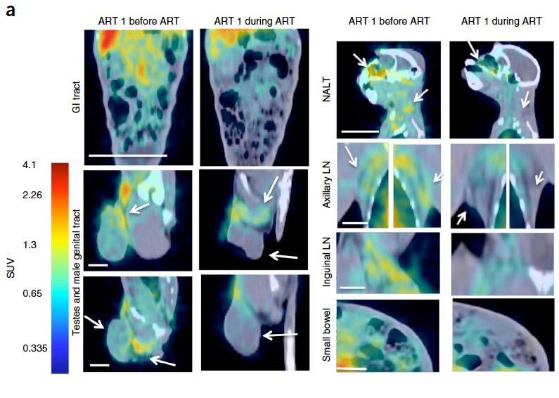 SIV Dynamics by Whole Body ImmunoPET In ART treated, aviremic macaques, all organs exhibited decreased uptake of the immunopet probe.