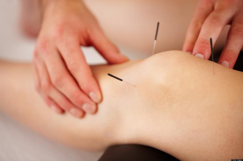 Acupuncture Beats Ibuprofen For Knee Arthritis Published by HealthCMI on 1 March 2018.