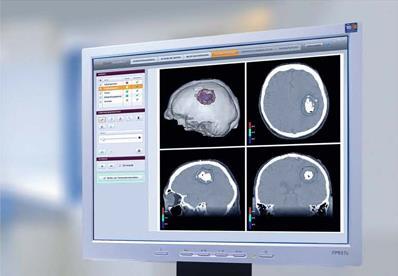 simulation takes into account the tumor size, distribution of the Nano- Therm particles and tumor location Magnetic field