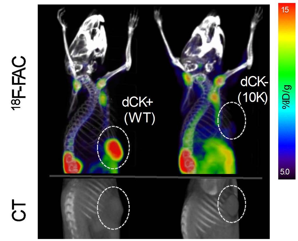 18 F-FAC distinguishes dck-positive and dck-negative tumors and predicts responses to gemcitabine mouse 1 mouse 2 10 4 tumor volume