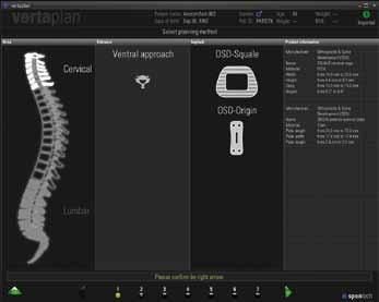 pelvis Lumbar spine: multi-segment implant planning with analysis of functional images and versatile measuring tools Supports various implant systems With the new version of you can now plan not only