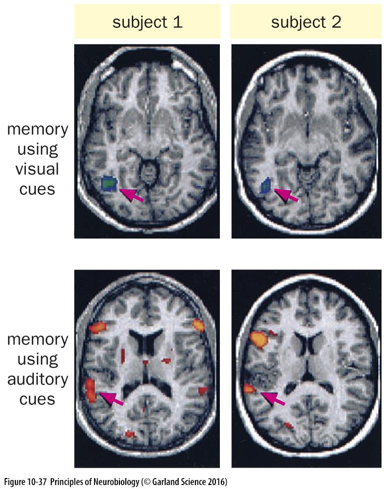 Using MRI scanning to record brain activity in humans Major drawbacks: Poor resolution -