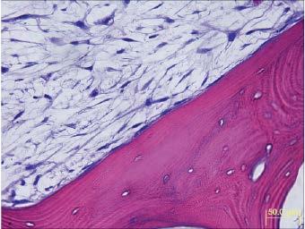 Figure 1: Histology of direct cell attachment to matrix Conformable The flexible cancellous tissue can be compressed for precise placement and is easily cut to accommodate irregular shapes and sizes.