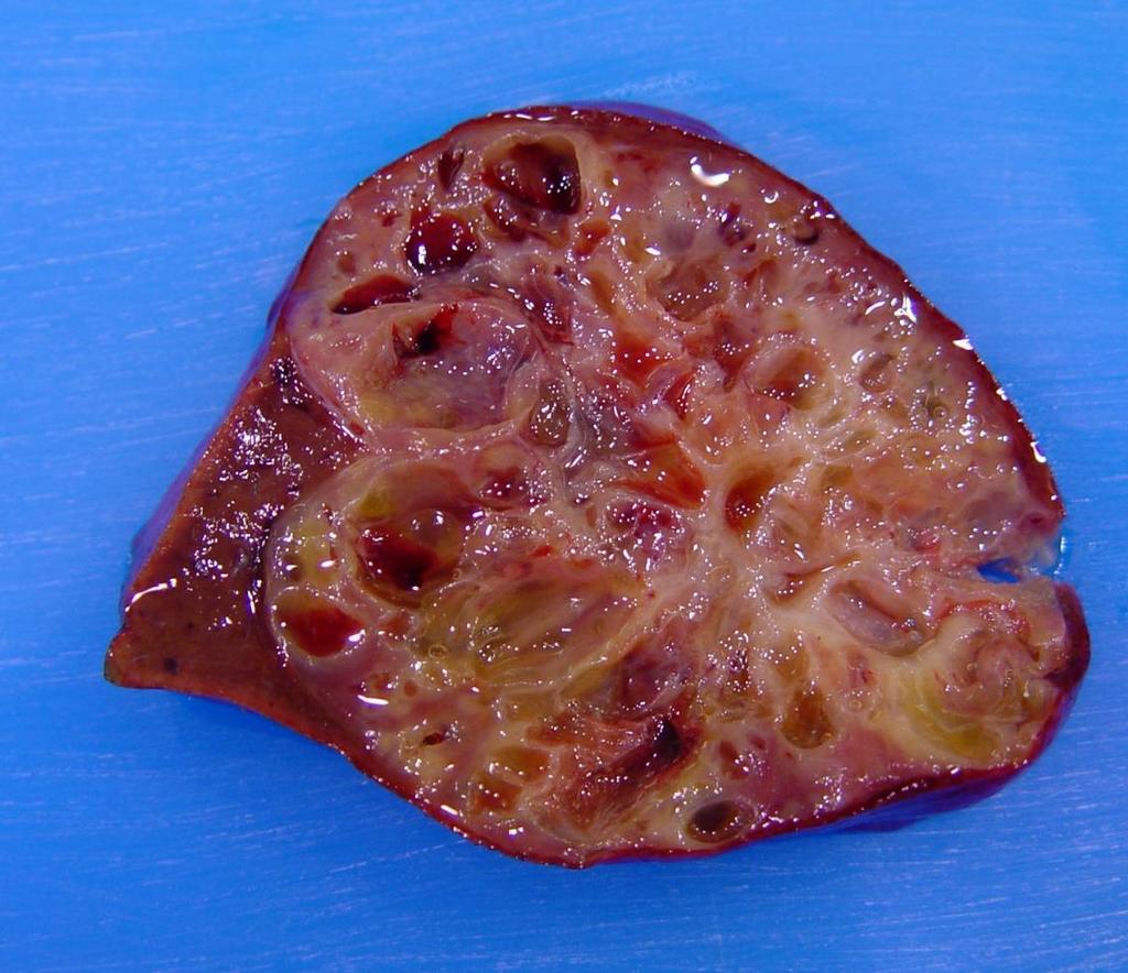 Special Features cut surface Cystic (containing cavities),