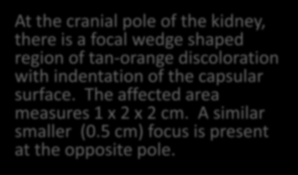 Gross Pathology Descriptions At the cranial pole of the kidney, there is a focal wedge shaped region of tan-orange discoloration with