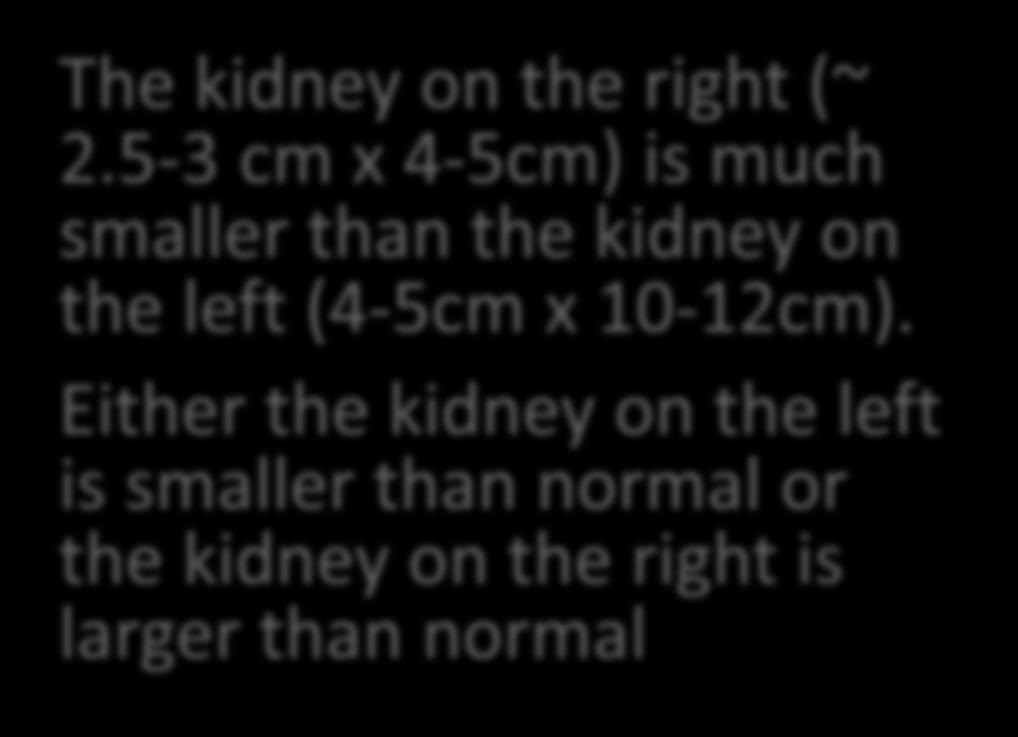 5-3 cm x 4-5cm) is much smaller than the kidney on the left (4-5cm x 10-12cm).