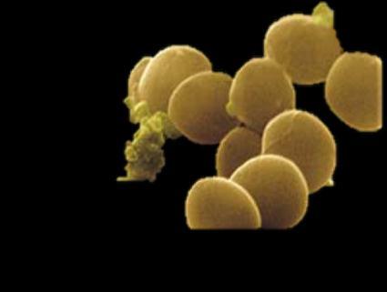Discussion Gram-positive bacteria, Staphylococcus aureus and, especially in the United States, vancomycin-resistant