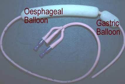 Esophageal Varices treatment Balloon tamponade: -