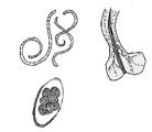 MUSCLE Toxoplasma, Sarcocystis Tapeworm larvae Foetus Toxoplasma Protozoa LUNGS Lungworm Tapeworm larvae LARGE INTEST.