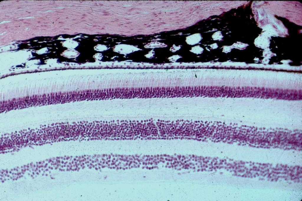 VI. NEUROECTODERMAL LAYER A. Pigment epithelium - outer layer optic cup. 1. Absorbs light, decreases reflection. 2. Phagocytoses discs in outer segments of photoreceptors. 3.