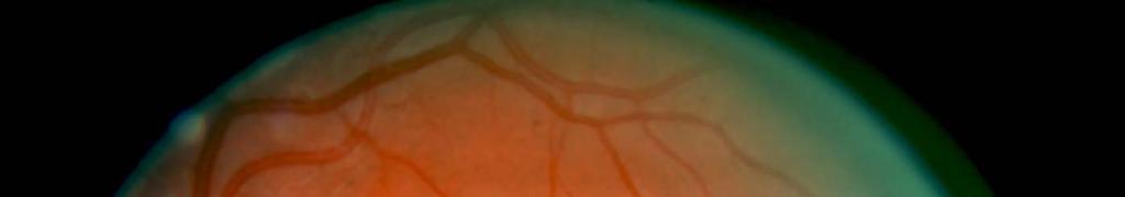 VII. RETINAL LANDMARKS A. Macula lutea - area of acute vision.