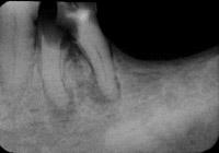 bilateral) 7. Floor of the mouth and lingual gingivae 8.