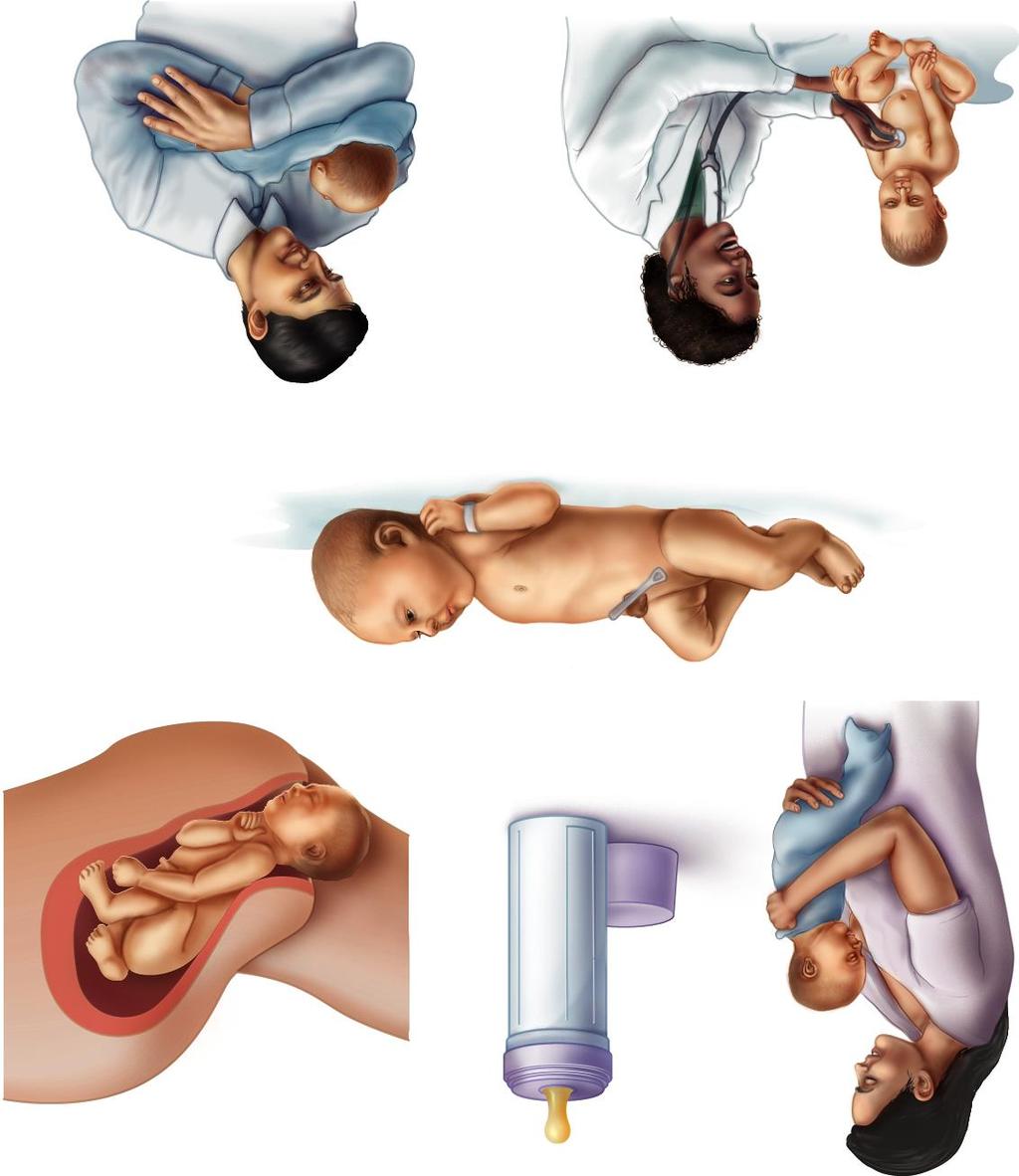 Initial colonization of the newborn Uterus and contents are normally sterile and remain so until just before birth