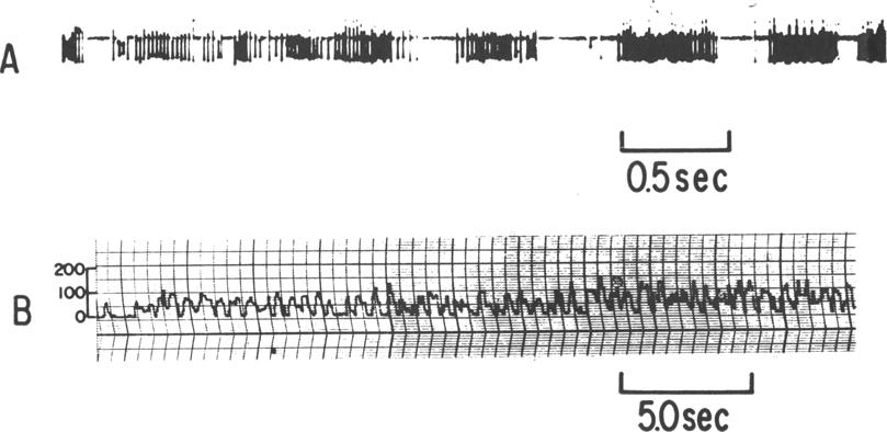 Electrical recording from the human cerebellum of the input of a Tektronix 122 preamplifier.