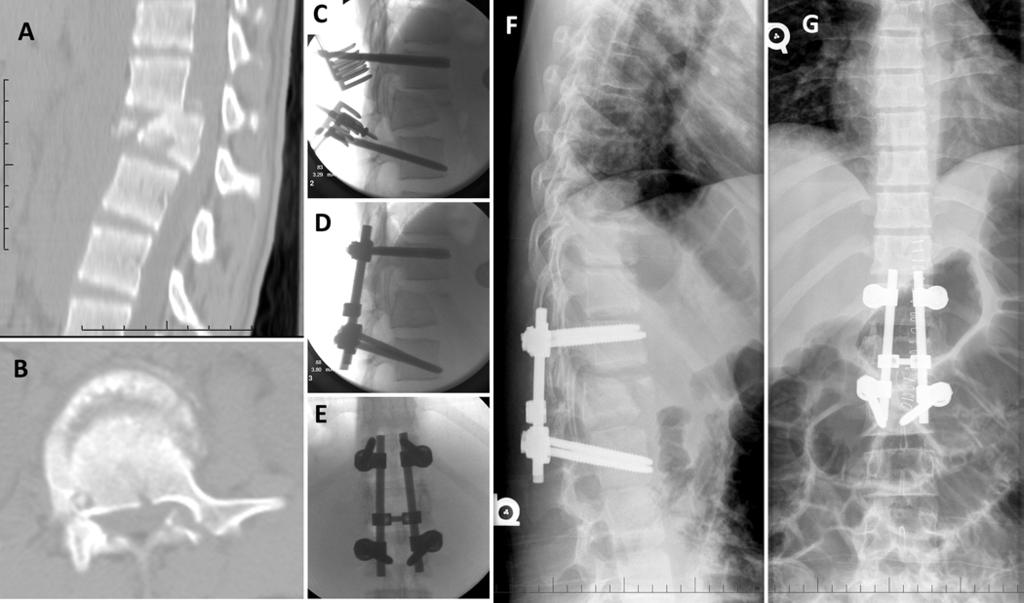 M. H. Weber et al. FIG. 3. Images obtained in a 19-year-old male victim of a motor vehicle accident who had presented with no neurological deficits.