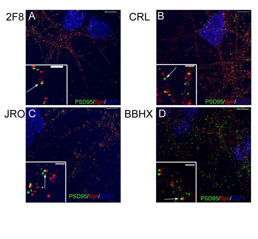 Supplementary Figure 7: Super-resolution microscopy to visualize synapses in ipsc-derived cortical neuron cultures.