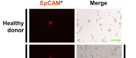 EpCAM + cells are found in patients and