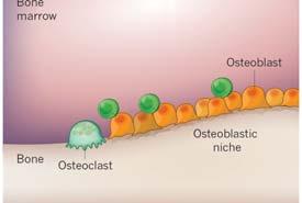 site Reality Prostate epithelial cancer DCCs